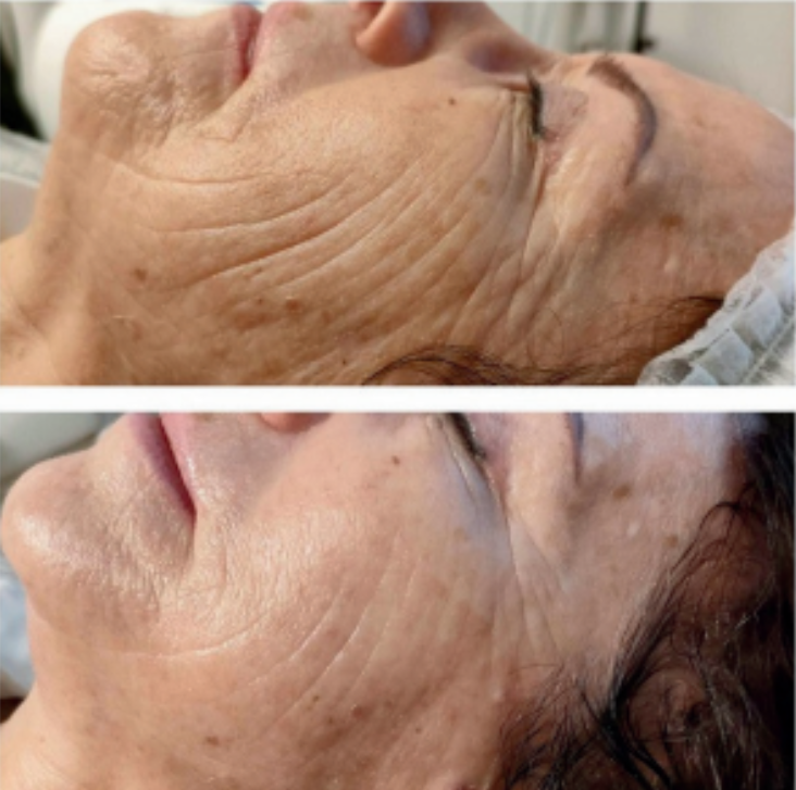 Sekret Wiecznej Młodości